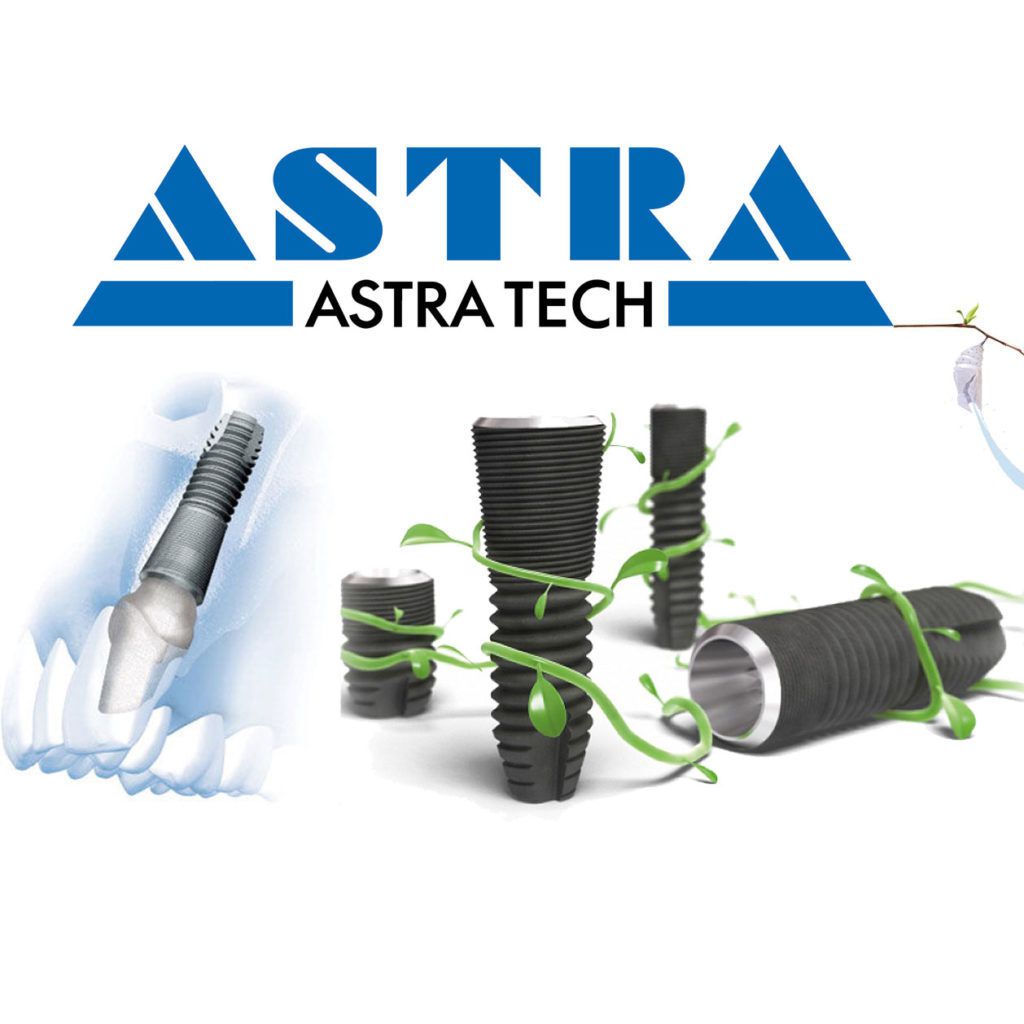 Astra Tech EV